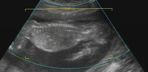 16 �������